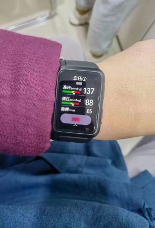 Boîtier Huawei Watch D et relevés de tension artérielle (images : via Weibo)